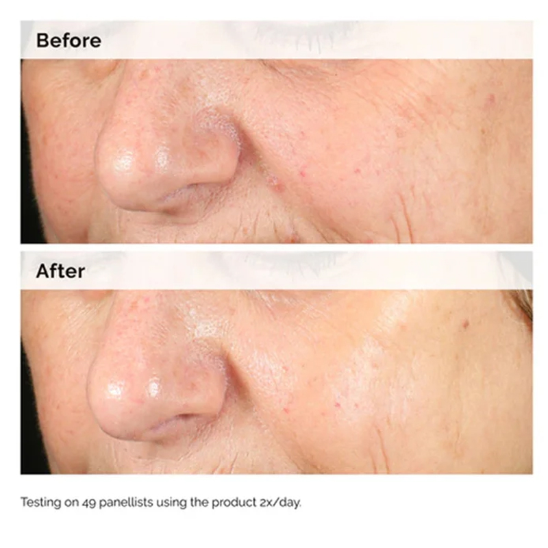 ألفا أربوتين 2% + HA 30 مل مصل - مراجعة Alpha Arbutin Serum وسعره