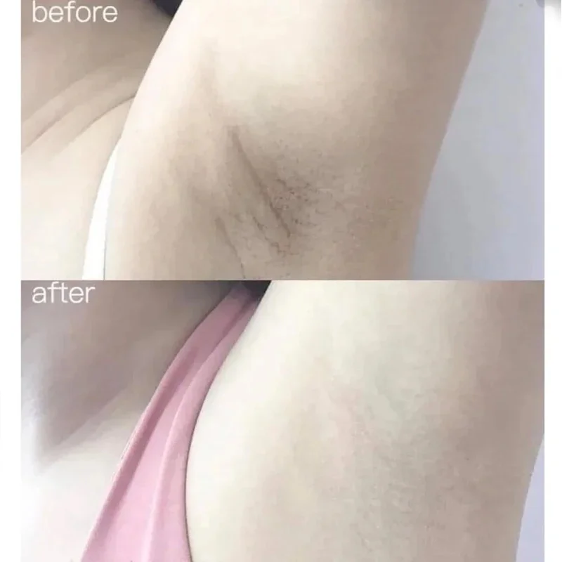 100 مللي ألفا أربوتين كولاجين  - مراجعة Alpha Arbutin Serum وسعره