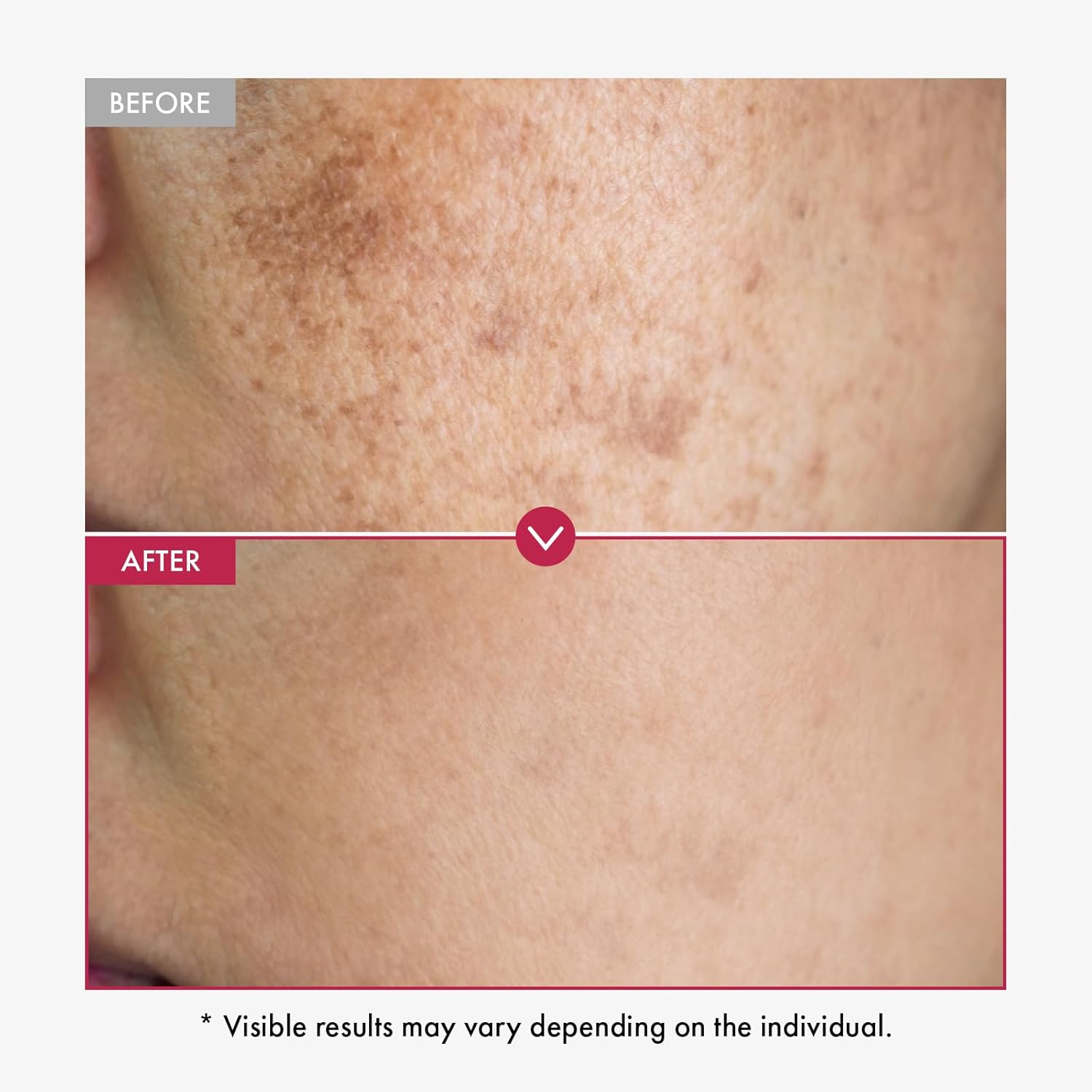 ألفا أربوتين مصل AHA يبقي مصل  - مراجعة Alpha Arbutin Serum وسعره