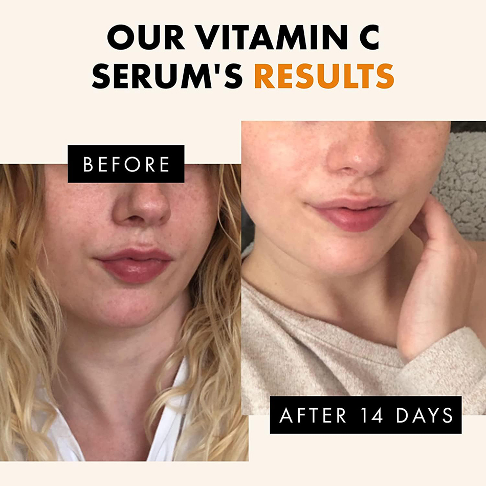 سيروم تفتيح بشرة الوجه بفيتامي - مراجعة Skincare Garnier وسعره