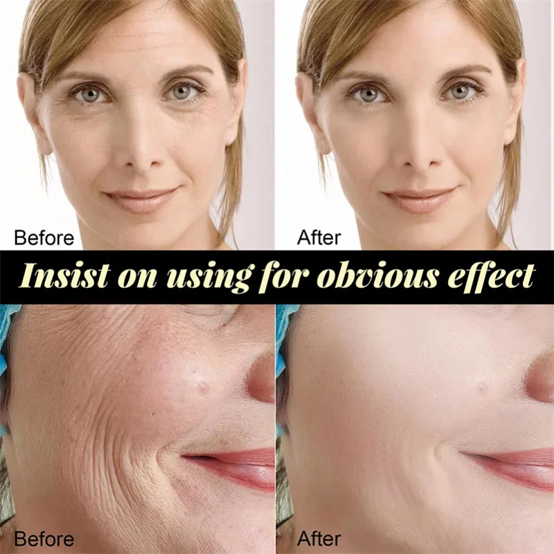 طقم رفع خيط البروتين شد الوجه  - مراجعة Skincare Garnier وسعره