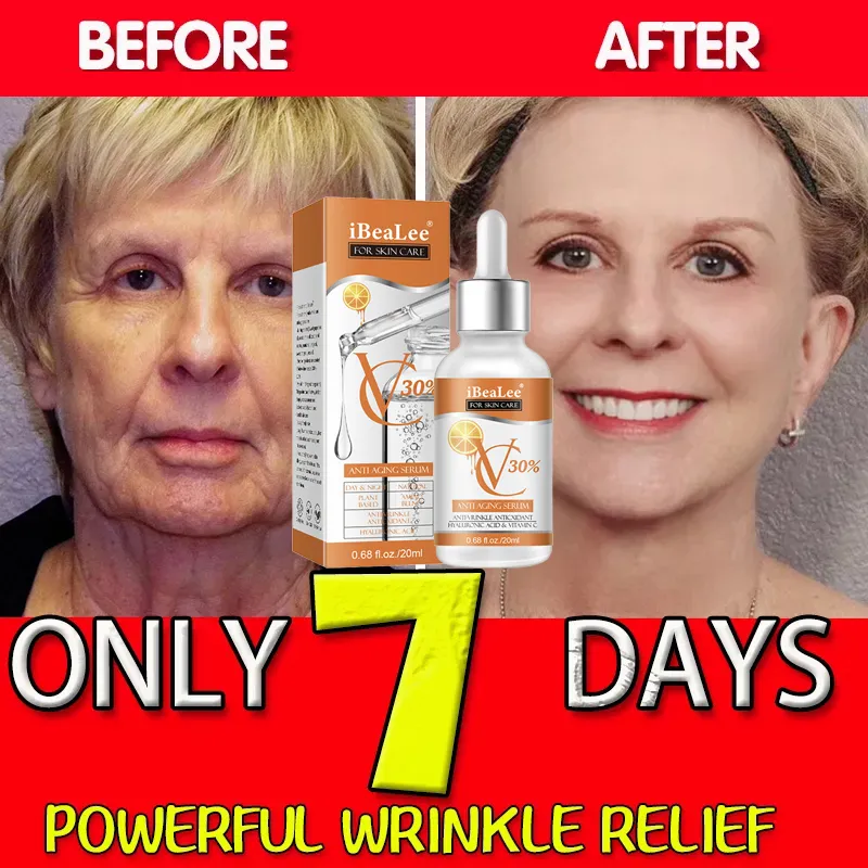 سيرم ريتينول حمض الهيالورونيك  - مراجعة Skincare Garnier وسعره