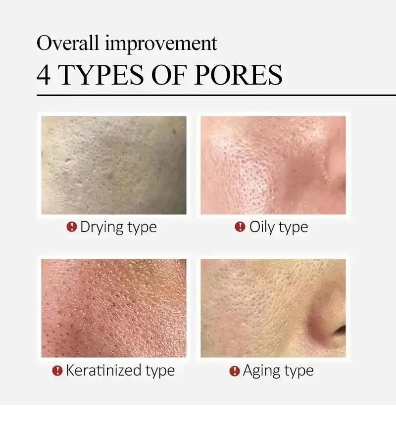 سيروم للوجه من سنتيلا أسياتيكا - مراجعة Centella Asiatica Toner وسعره
