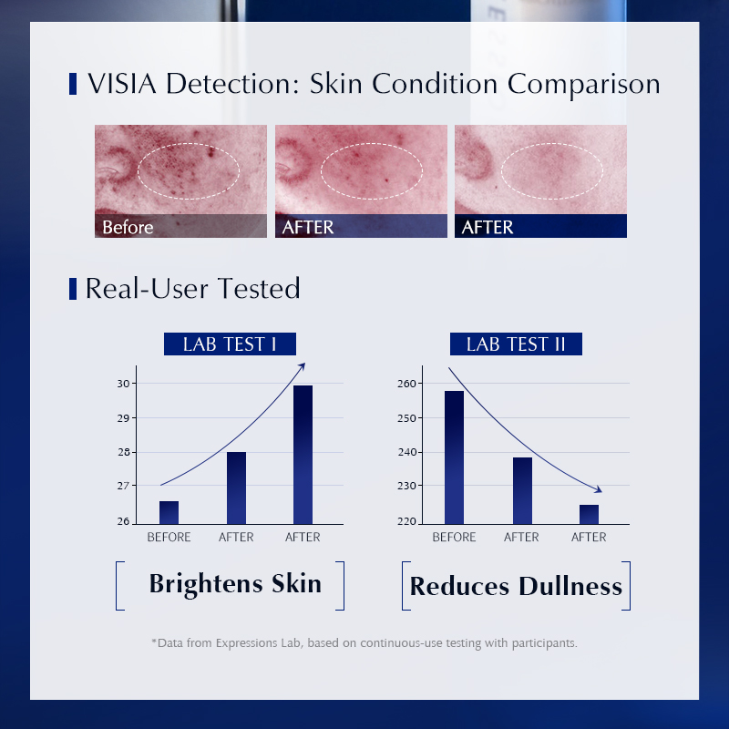 سيروم تفتيح البقع الداكنة مع ا - مراجعة Alpha Arbutin Serum وسعره