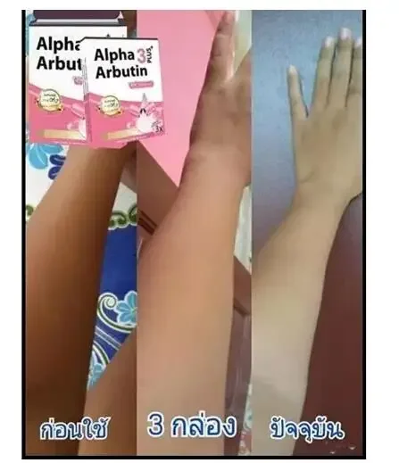 ألفا أربوتين 3 بلس مسحوق مزيج  - مراجعة Alpha Arbutin Serum وسعره